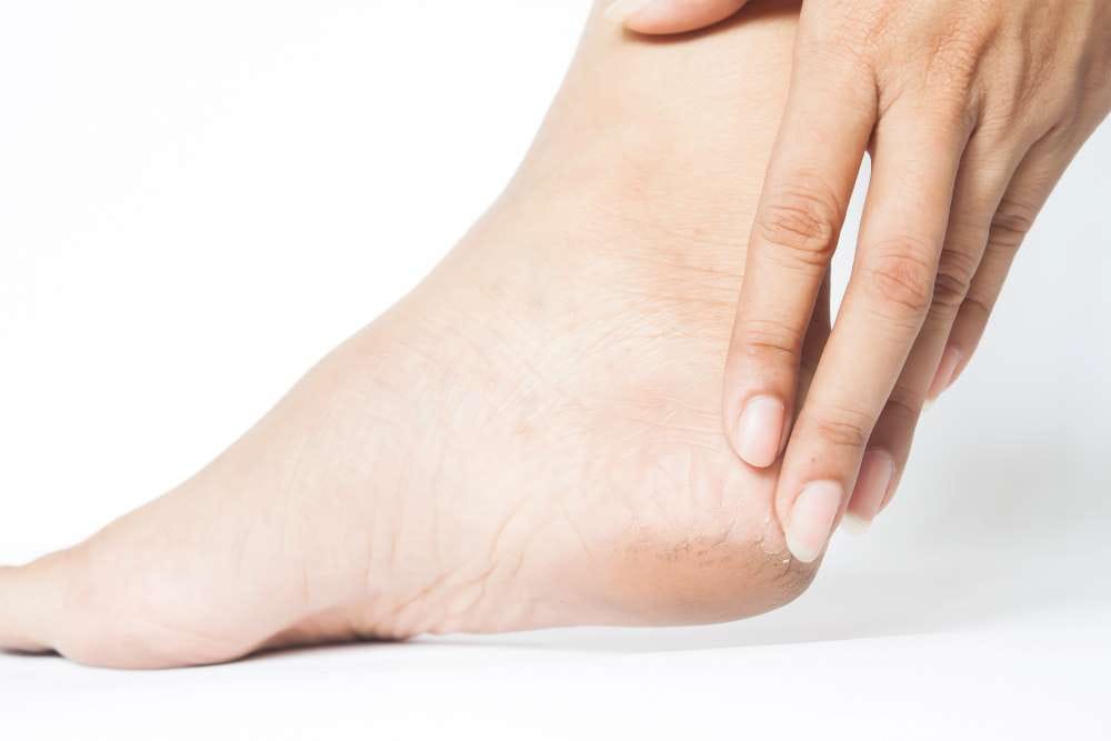 چگونه از پاهای خشک و ترک خورده مراقبت کنیم
