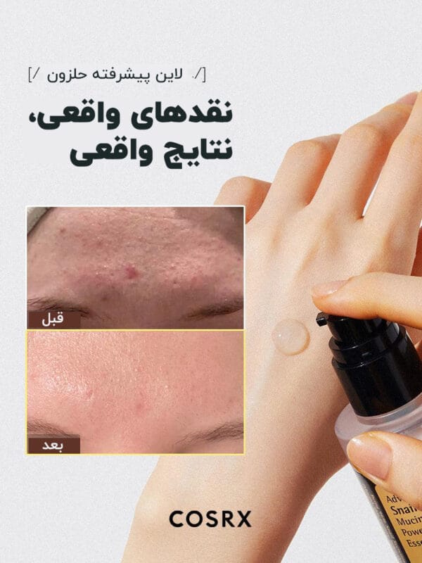 نقد اسنس حلزون کوزارکس