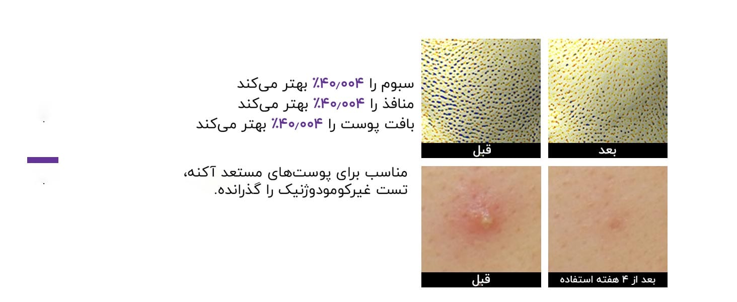 تاثیر سرم رتینول قوی صورت سام بای می بر پوست