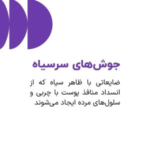 جوش‌های سرسیاه