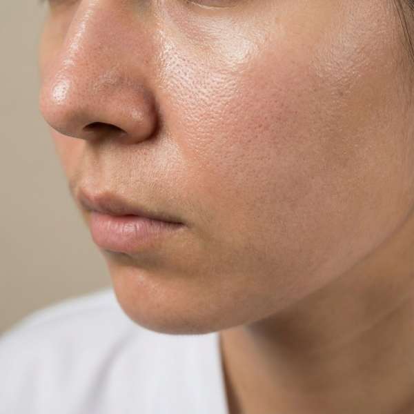 منافذ باز پوستی