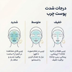 مقیاس تصویری درجه‌بندی شدت چربی پوست از حالت خفیف (ناحیه T) تا شدید (کل صورت).