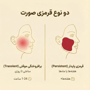 انواع قرمزی و برافروختگی صورت