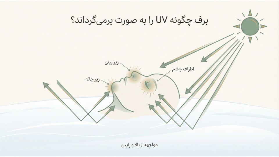 تصویر آموزشی بازتاب اشعه خورشید از برف و برخورد UV به زیر چانه و اطراف چشم