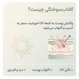 اینفوگرافیک تعریف علمی آفتابسوختگی، نمایش لایههای پوست آسیبدیده با اشعه فرابنفش و علائم اولیه مثل التهاب و قرمزی