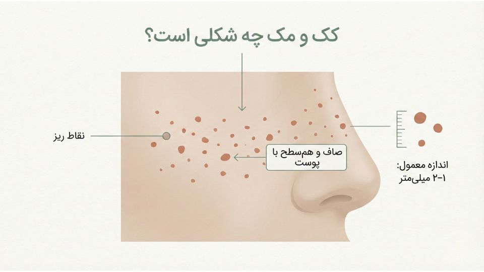 «تصویر آموزشی تشخیص کک و مک روی گونه و بینی با نمایش اندازه تقریبی ۱ تا ۲ میلی‌متر»​