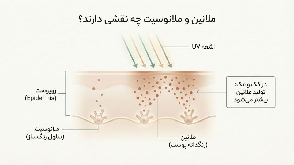 «تصویر آموزشی لایه‌های پوست با برچسب ملانوسیت و ملانین و تاثیر اشعه UV در پررنگ شدن کک و مک»