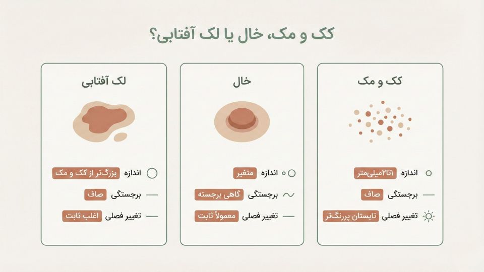 «اینفوگرافیک تفاوت کک و مک با خال و لک آفتابی با سه کارت و معیارهای اندازه، برجستگی و تغییر فصلی»
