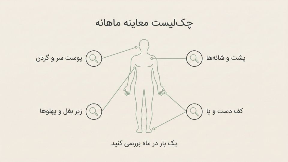 اینفوگرافیک راهنمای معاینه شخصی پوست شامل بررسی سر، گردن، پشت، زیر بغل و کف دست و پا