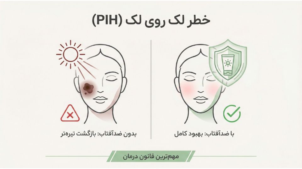تصویر هشدار درباره بازگشت لک (PIH) در صورت عدم استفاده از ضدآفتاب بعد از لیزر