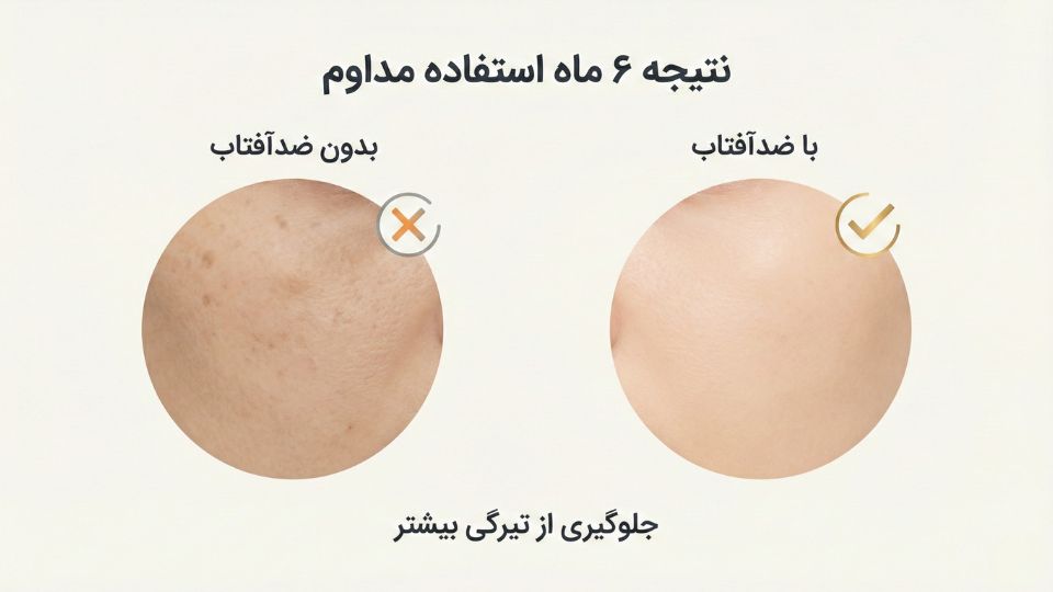 مقایسه وضعیت لک‌های پوست با و بدون استفاده از ضدآفتاب پس از ۶ ماه

