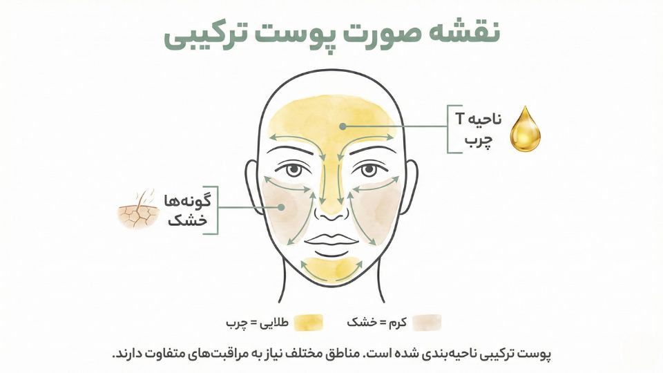 نقشه صورت برای پوست مختلط: ناحیه T چرب و گونهها خشک/متعادل