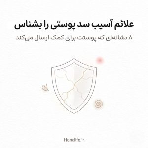 تصویر سپر ترک‌خورده‌ای با علائم بصری خشکی و تحریک — علائم آسیب سد پوستی — هانالایف