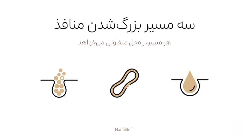 اینفوگرافیک سه مکانیزم بزرگ‌شدن منافذ پوست، سبوم، کلاژن و فولیکول