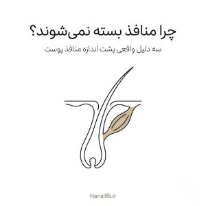 تصویر فولیکول پوست بدون کنترل عضلانی نمادین برای بستن منافذ پوست — هانالایف