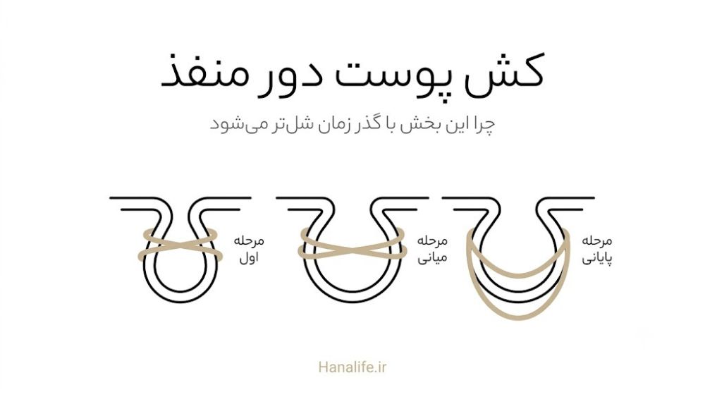 الگوی کاهش کلاژن و الاستین دور منفذ پوست در طول زمان — هانالایف