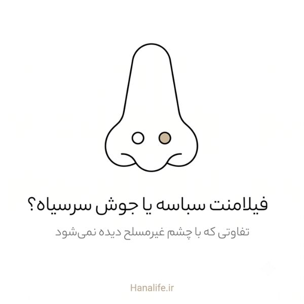 دو نقطه شبیه به هم روی بینی که فیلامنت سباسه را نشان می‌دهند — هانالایف