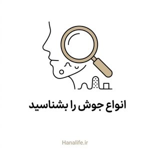 بزرگنمایی چهار نوع برجستگی پوستی مختلف روی صورت — انواع جوش — هانالایف