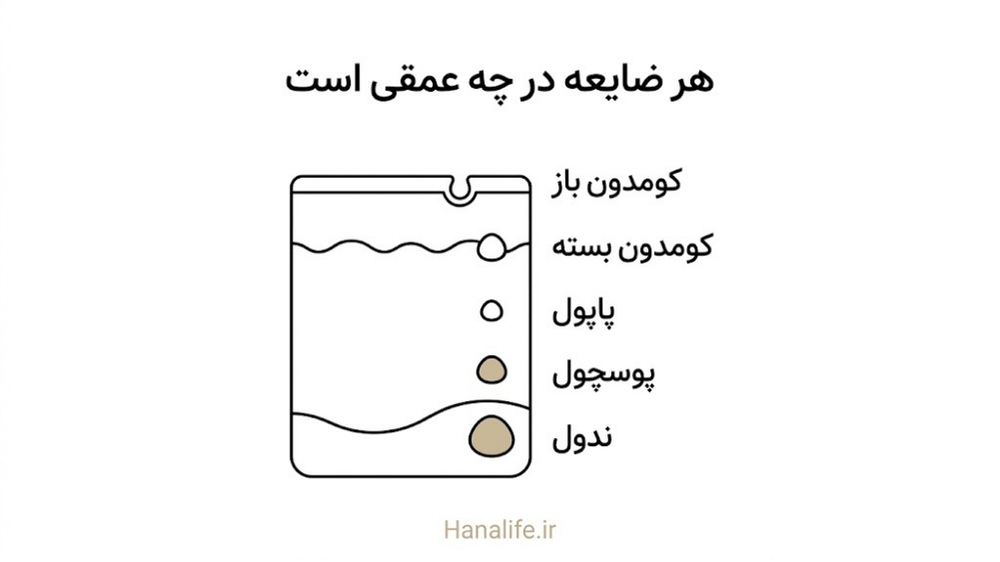 مقطع پوست با پنج ضایعه آکنه در پنج عمق متفاوت — انواع جوش — هانالایف