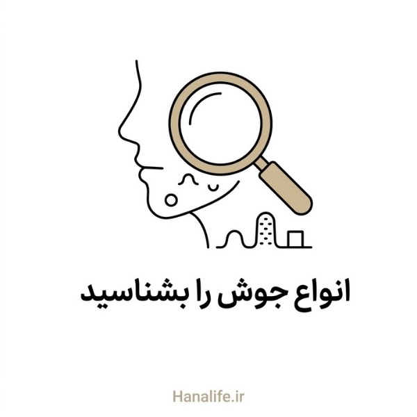 بزرگنمایی چهار نوع برجستگی پوستی مختلف روی صورت — انواع جوش — هانالایف