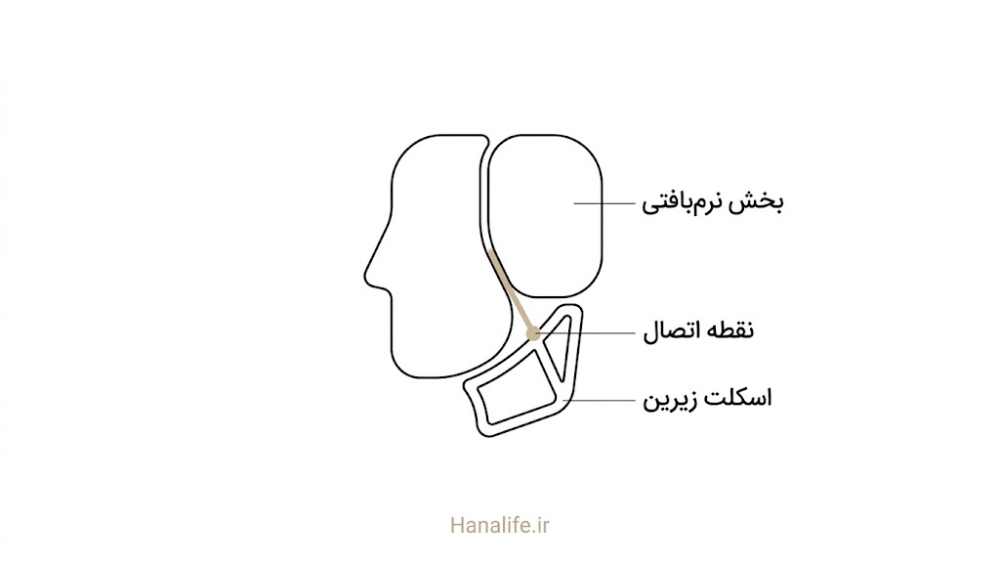 دو بخش نرم‌بافتی صورت روی اسکلت زیرین کوچک‌شده — شیار صورت — هانالایف