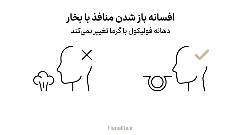 مقایسه افسانه باز شدن منافذ با بخار در برابر دهانه فولیکول ثابت — منافذ باز پوست — هانالایف