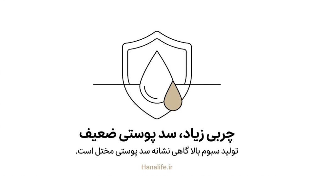  قطره چربی سرریزشده از زره نازک، نماد عدم تعادل روتین پوست چرب — روتین پوست چرب — هانالایف
