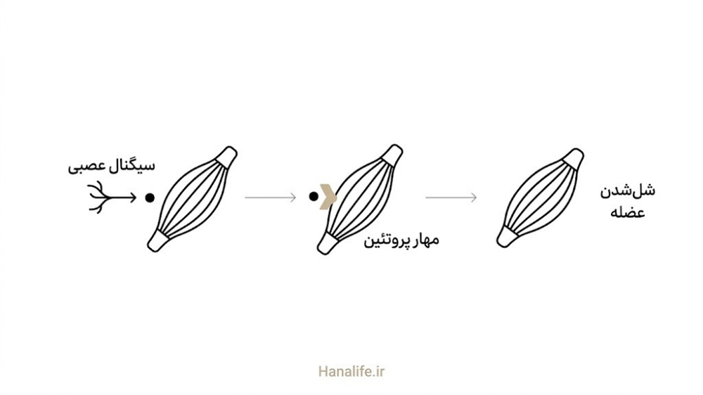 نمایش سه مرحله مهار سیگنال عصبی تا شل‌شدن عضله توسط بوتاکس — مکانیسم بوتاکس — هانالایف