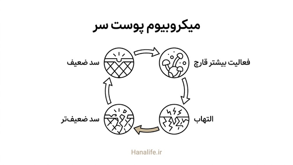 چرخه ارتباط سد پوستی ضعیف، فعالیت قارچ و التهاب در میکروبیوم پوست سر — میکروبیوم پوست سر — هانالایف