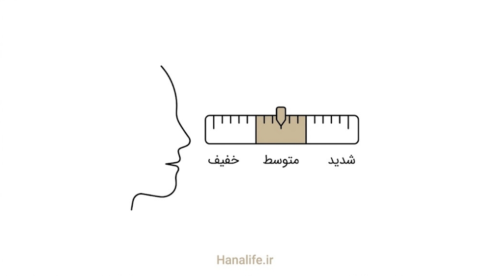 خط‌کش شدت آکنه کنار سیلوئت صورت با سه ناحیه خفیف متوسط شدید — آکنه خفیف — هانالایف