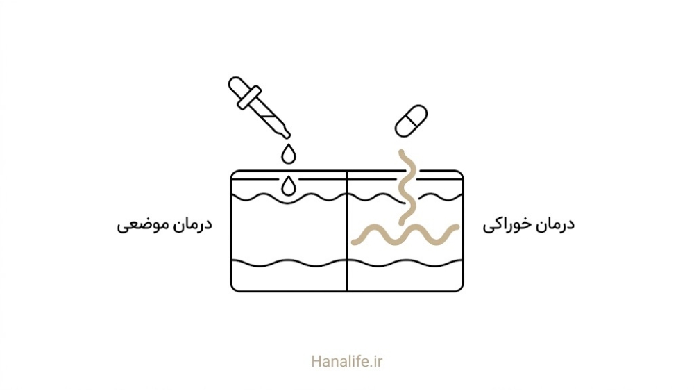 مقایسه عمق نفوذ درمان موضعی و خوراکی در لایه‌های پوست — درمان آکنه — هانالایف