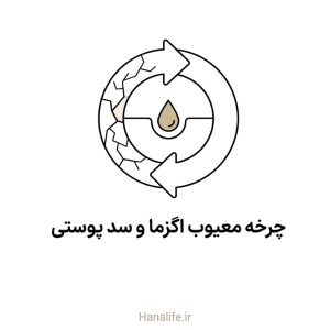 حلقه دایره‌ای شکسته نمادین چرخه معیوب اگزما و سد پوستی — هانالایف