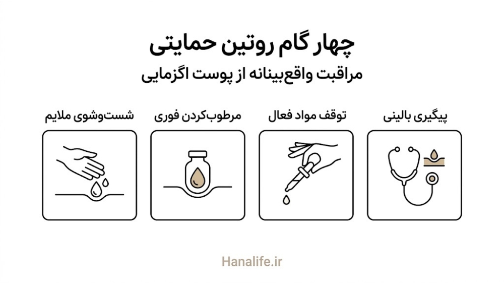 چهار مرحله روتین حمایتی سد پوستی برای پوست اگزمایی — روتین سد پوستی — هانالایف