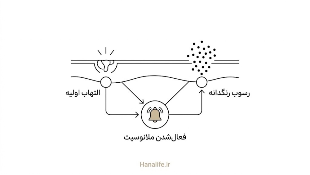 مسیر التهاب تا رسوب رنگدانه در سه مرحله — مکانیزم PIH — هانالایف