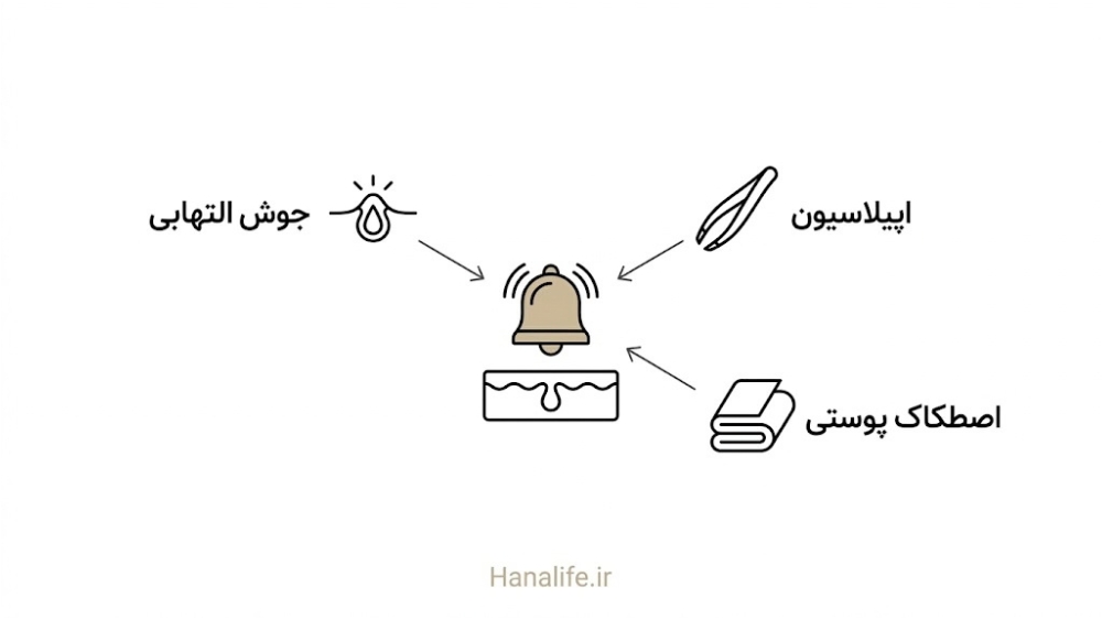 سه محرک رایج زنگ هشدار ملانوسیت — لک بعد از التهاب — هانالایف