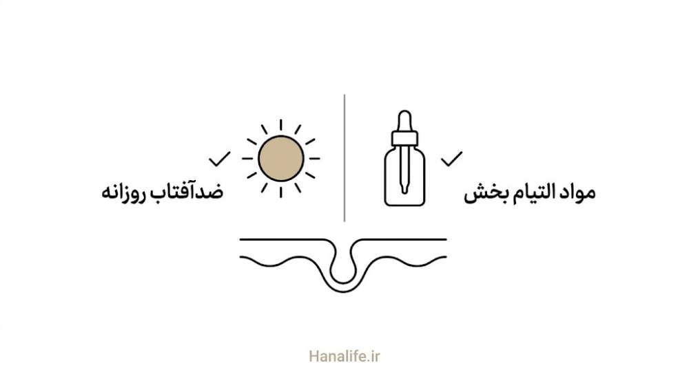 ضدآفتاب و مواد آرامکننده برای پیشگیری از PIH — کاهش ریسک PIH — هانالایف
