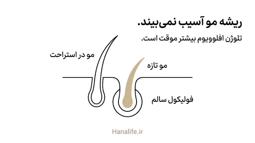 برش پوست سر: مو در استراحت، فولیکول سالم و مو تازه در حال آغاز رشد در تلوژن افلوویوم