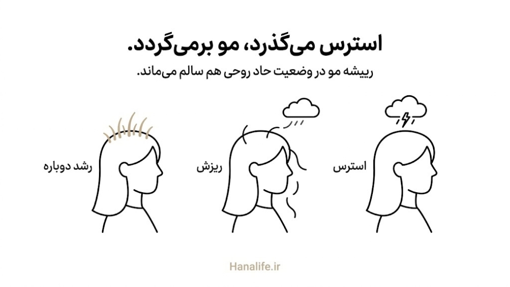 سه مرحله ریزش مو بعد از استرس: ابر استرس، ریزش موها و رشد دوباره در تلوژن افلوویوم حاد