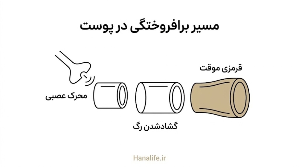  مراحل گشادشدن رگ‌های سطحی صورت هنگام برافروختگی — مکانیسم برافروختگی صورت