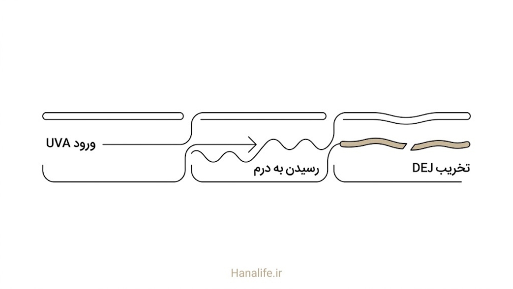 سه مرحله نفوذ UVA به درم و آسیب تدریجی به مرز DEJ — نور مرئی و پوست — هانالایف