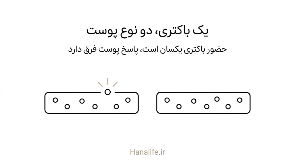 باکتری آکنه به یک اندازه روی پوست سالم و پوست مبتلا به آکنه دیده می‌شود — هانالایف