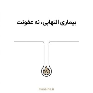 آکنه چیست؛ التهاب پنهان درون فولیکول پیش از عفونت یا آلودگی پوست — هانالایف