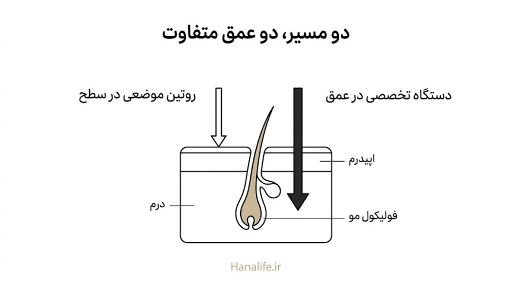 برش عرضی پوست با دو مسیر متفاوت نفوذ محصول موضعی و دستگاه تخصصی — درمان تخصصی منافذ — هانالایف