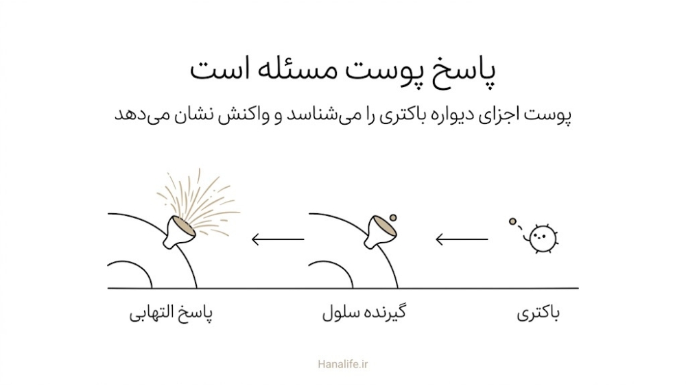  سه مرحله پاسخ پوست به باکتری آکنه: شناسایی باکتری، گیرنده روی سلول و واکنش التهابی