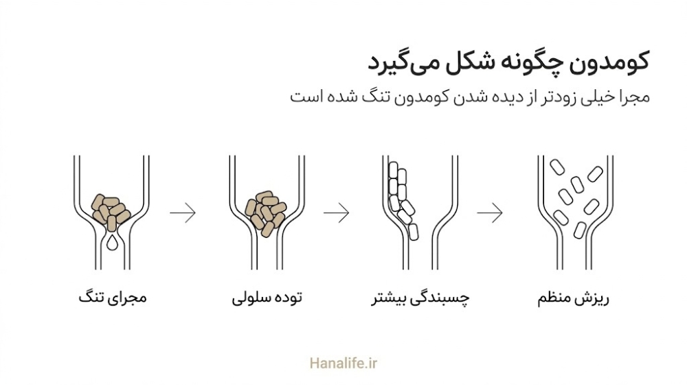 چهار مرحله شکل‌گیری کومدون از ریزش منظم سلول‌ها تا چسبندگی، توده سلولی و تنگ شدن مجرای فولیکول