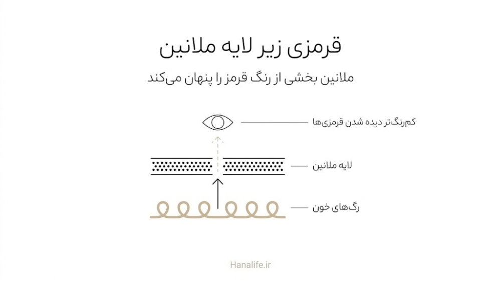 برش ساده پوست با لایه ملانین که قرمزی رگهای خون را در پوست گندمی کمرنگتر نشان میدهد