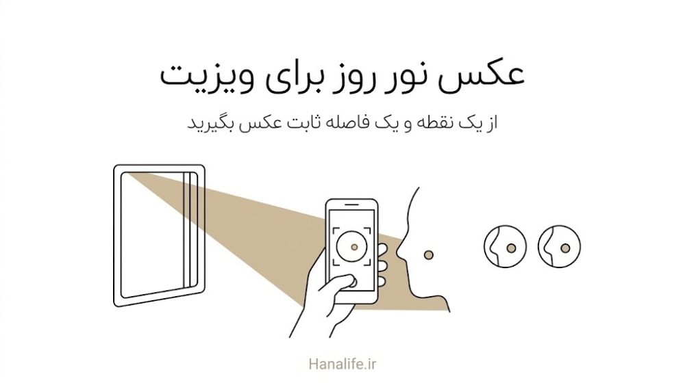 دستی با گوشی از یک نقطه ثابت گونه کنار پنجره عکس میگیرد تا روند قرمزی صورت برای ویزیت ثبت شود