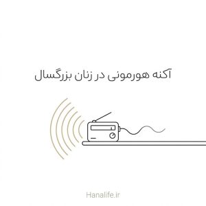 رادیویی با سیگنال آرام ورودی و صدای بلند خروجی، استعاره آکنه هورمونی در زنان — آکنه هورمونی — هانالایف