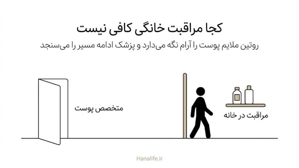 آستانه‌ای میان مراقبت ملایم در خانه و مراجعه به متخصص پوست برای جوش خط فک و آکنه بزرگسالی