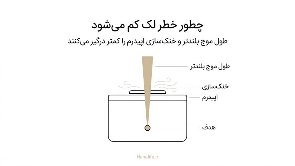 برش دو پوست روشن و تیره؛ در پوست سبزه ملانین اپیدرم بخشی از نور لیزر را پیش از هدف جذب میکند
